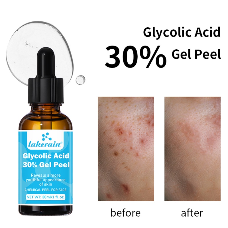 Lactic Acid Toner - 30% Glycolic Acid Peel Gel Professional