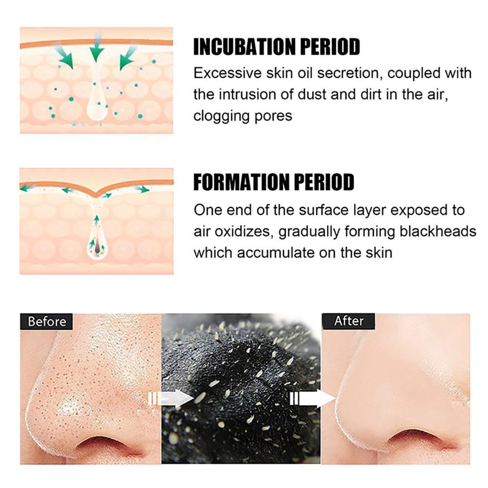 10/20/50/100PCS Nose Blackhead - Charcoal Pore Strip ulasan dan harga