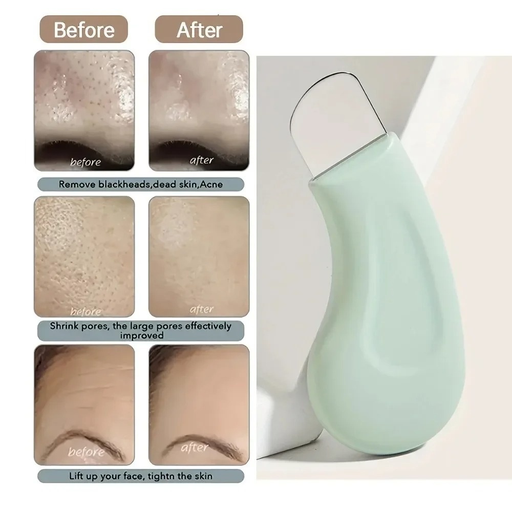 Deep Cleansing Blackhead White - Skincare Routine ulasan dan harga