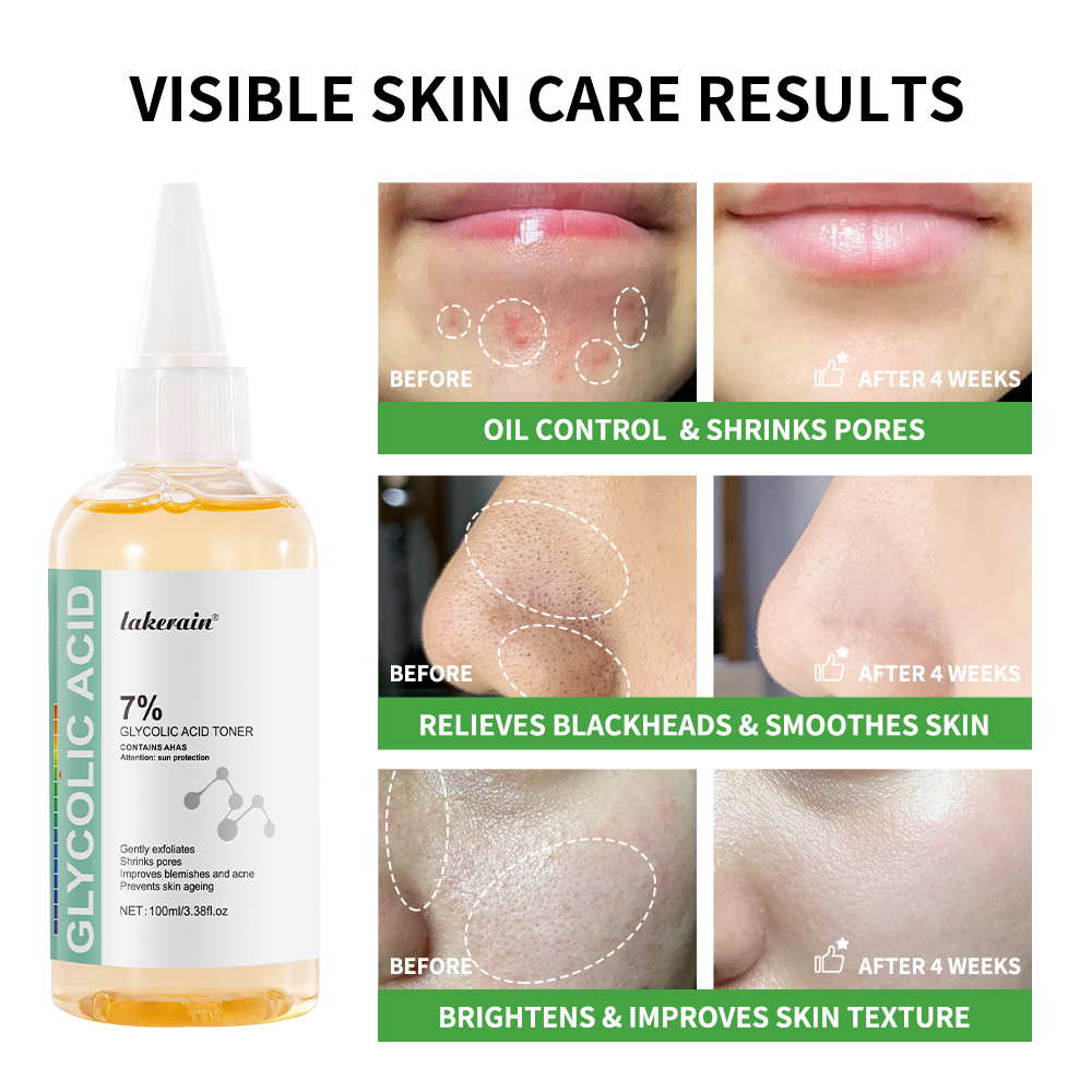 Glycolic Acid 7% Toning Soluti - Lactic Acid Toner ulasan dan harga