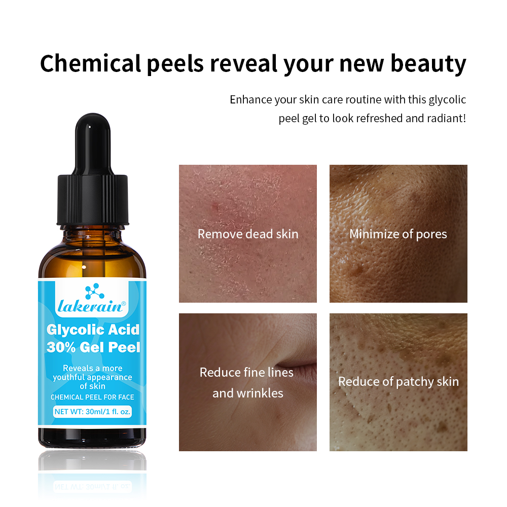 30% Glycolic Acid Peel Gel Pro - Lactic Acid Toner ulasan dan harga