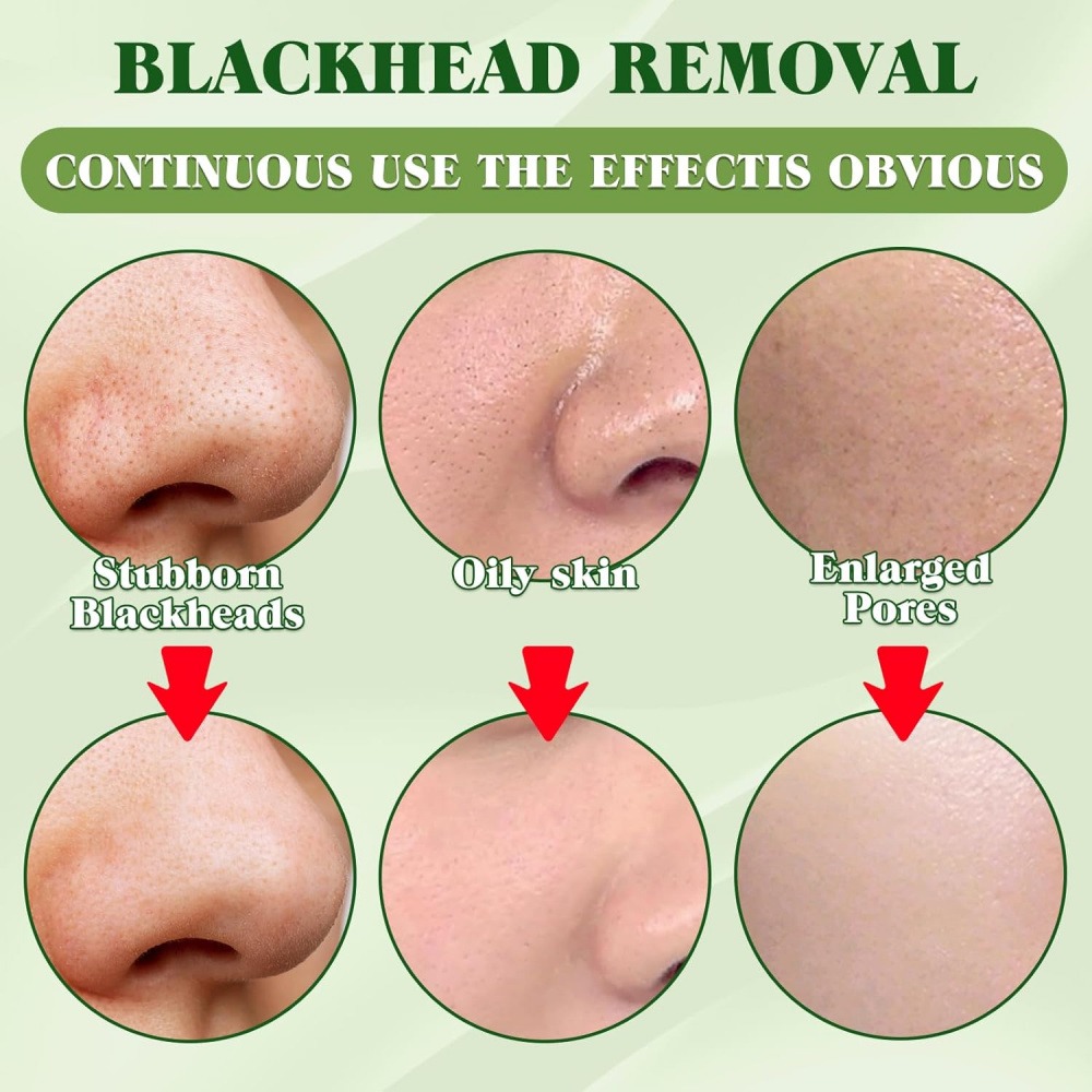 15 Pack Blackhead Remover Nose - Charcoal Pore Strip ulasan dan harga